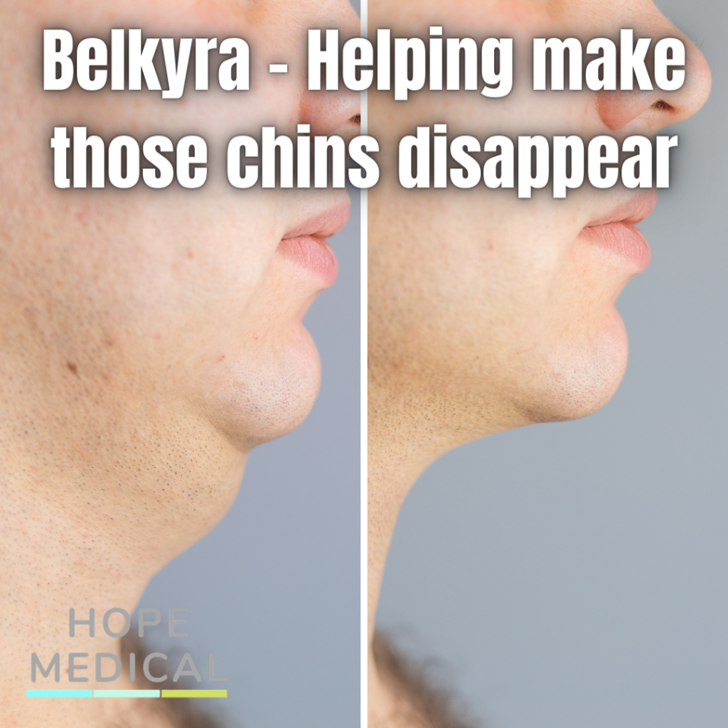 belkyra