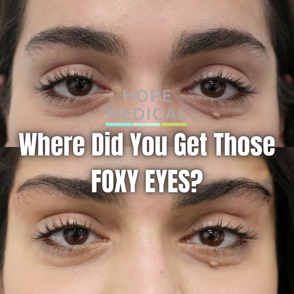 foxy eyes